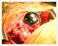 Slider image (10) Dr. A. K. Venkatachalam MJRC Clinic